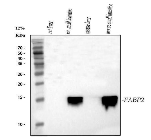 Anti-FABP2/I-FABP Antibody Picoband® Boster Bio