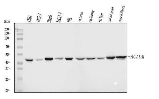Anti-ACADM/MCAD Antibody Picoband® Boster Bio