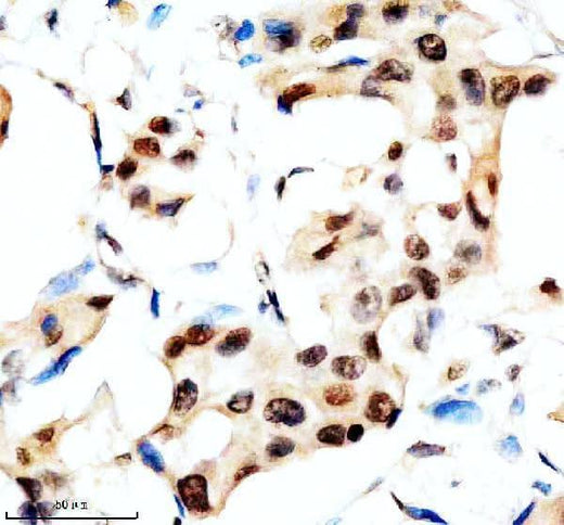 Anti-SLX4 Antibody Boster Bio