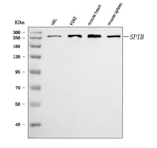 Anti-beta 1 Spectrin/SPTB Antibody Picoband® Boster Bio