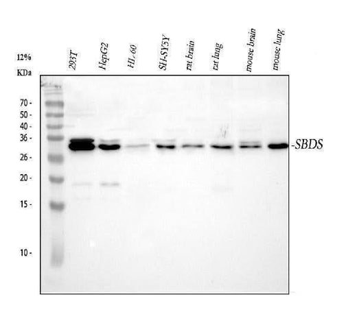 Anti-SBDS Antibody Picoband® Boster Bio