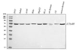Anti-LTA4H Antibody Picoband® Boster Bio