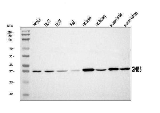 Anti-GNB3 Antibody Picoband® Boster Bio