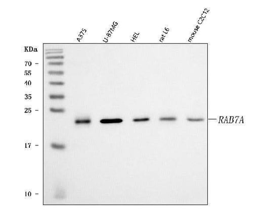 Anti-RAB7/RAB7A Antibody Picoband® Boster Bio
