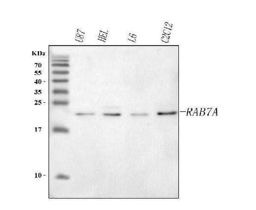 Anti-RAB7A Antibody Picoband® Boster Bio