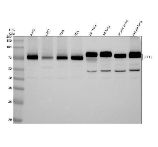 Anti-RECQL Antibody Picoband® Boster Bio