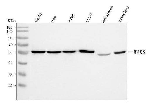Anti-WRS/WARS1 Antibody Picoband® Boster Bio
