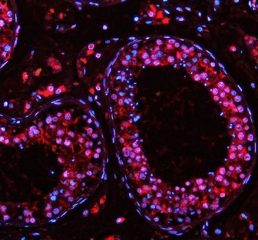 Anti-PABPN1 Antibody Picoband® Boster Bio