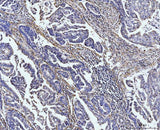 Anti-COL4A2 Antibody Boster Bio