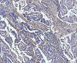 Anti-COL4A2 Antibody Boster Bio