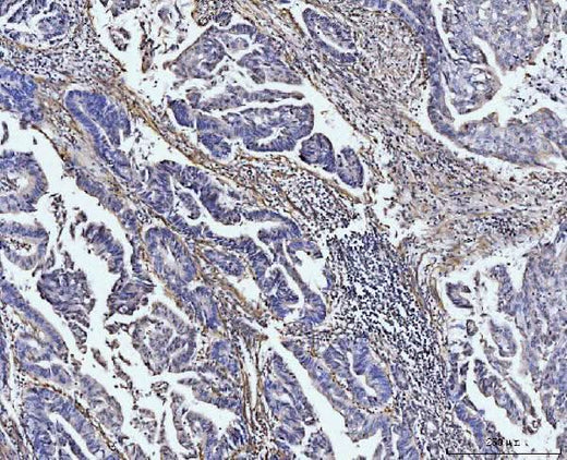 Anti-COL4A2 Antibody Boster Bio