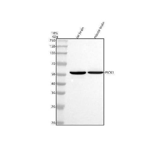 Anti-PICK1 Antibody Picoband® Boster Bio