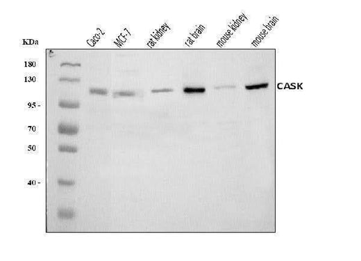 Anti-CASK Antibody Picoband® Boster Bio