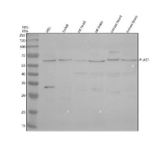 Anti-PLAG1 Antibody Picoband® Boster Bio