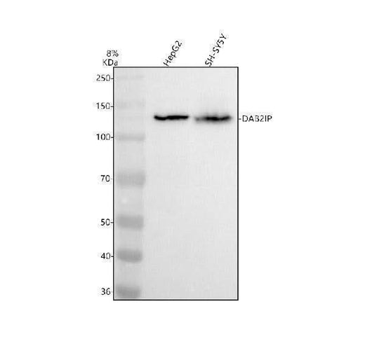 Anti-DAB2IP Antibody Picoband® Boster Bio