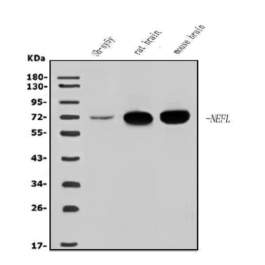Anti-NEFL/NF-L Antibody Picoband® Boster Bio