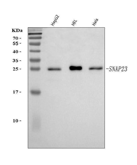 Anti-SNAP23 Antibody Picoband® Boster Bio