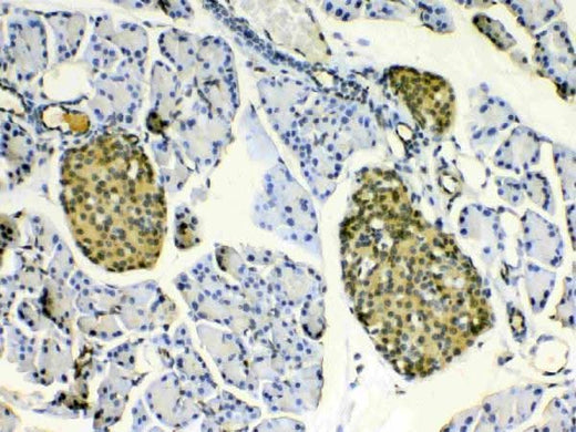 Anti-HSPB8/Hsp22 Antibody Picoband® Boster Bio