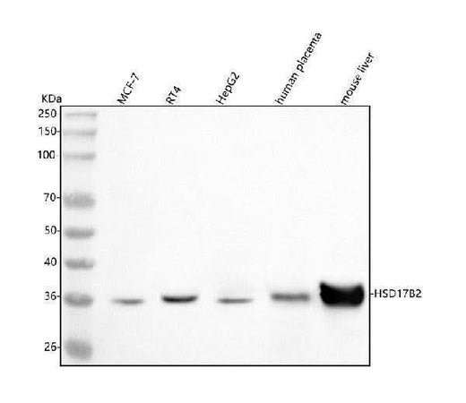 Anti-HSD17B2 Antibody Picoband® Boster Bio