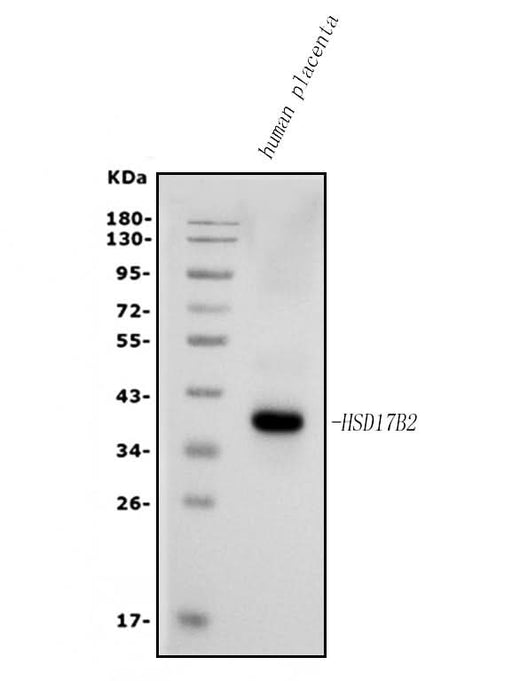 Anti-HSD17B2 Antibody Picoband® Boster Bio