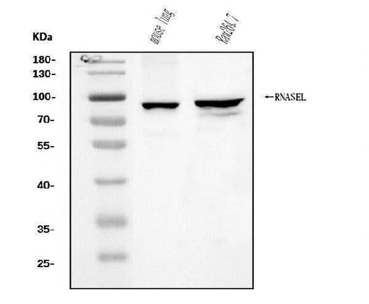 Anti-RNase L/Rnasel Antibody Picoband® Boster Bio