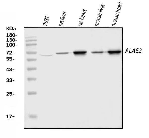 Anti-ALAS2/ASB Antibody Picoband® Boster Bio