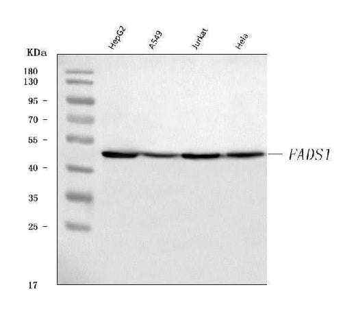 Anti-FADS1 Antibody Picoband® Boster Bio