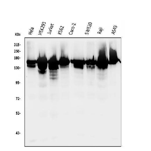 Anti-RNA Helicase A/DHX9 Antibody Picoband® Boster Bio