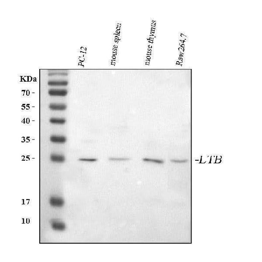 Anti-Ltb Antibody Picoband® Boster Bio
