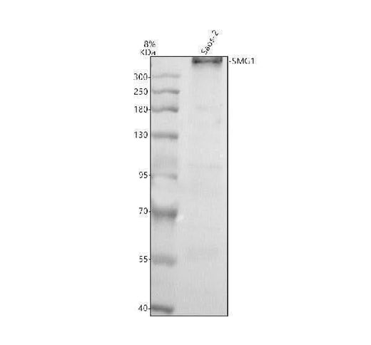 Anti-SMG1 Antibody Picoband® Boster Bio