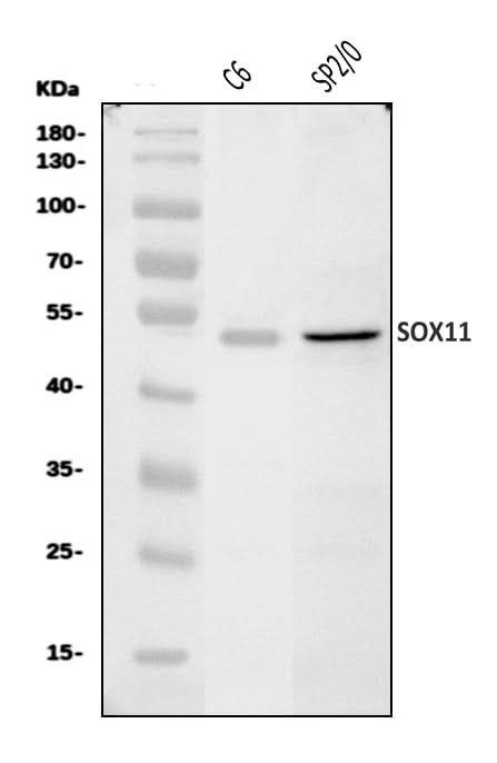 Anti-Sox11 Antibody Picoband® Boster Bio