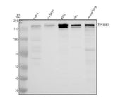 Anti-53BP2/TP53BP2 Antibody Picoband® Boster Bio