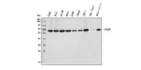 Anti-YTHDF2 Antibody Picoband® Boster Bio