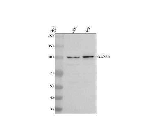 Anti-GUCY2D Antibody Picoband® Boster Bio