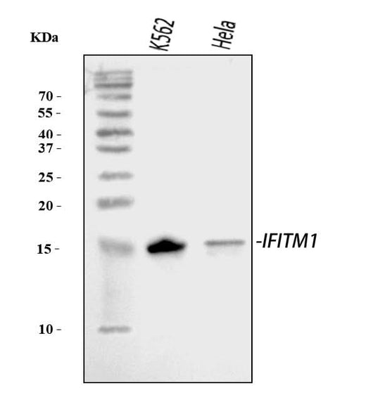 Anti-IFITM1 Antibody Picoband® Boster Bio