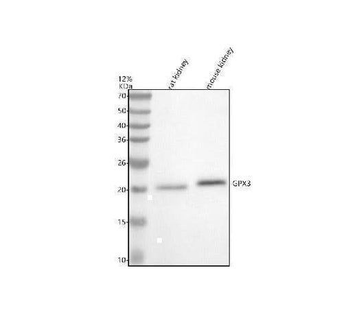 Anti-GPX3 Antibody Picoband® Boster Bio