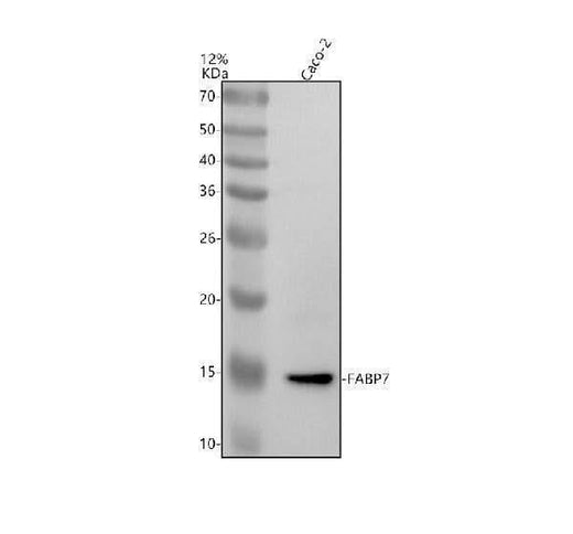 Anti-KDM3B Antibody Picoband® Boster Bio