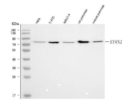 Anti-HRD1/SYVN1 Antibody Picoband® Boster Bio