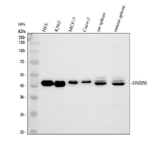 Anti-HMBS Antibody Picoband® Boster Bio