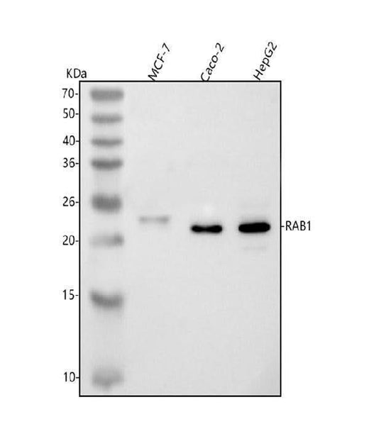 Anti-RAB1A Antibody Picoband® Boster Bio