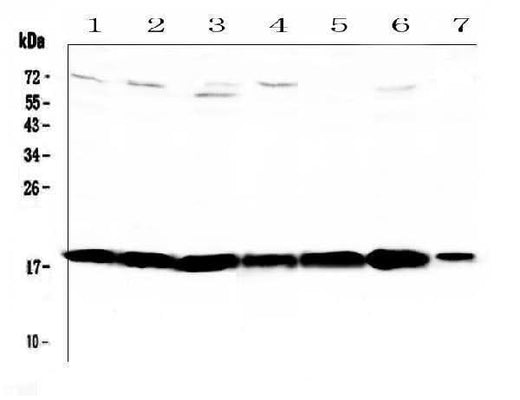 Anti-HE4/Wfdc2 Antibody Picoband® Boster Bio