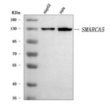 Anti-SNF2H/SMARCA5 Antibody Picoband® Boster Bio