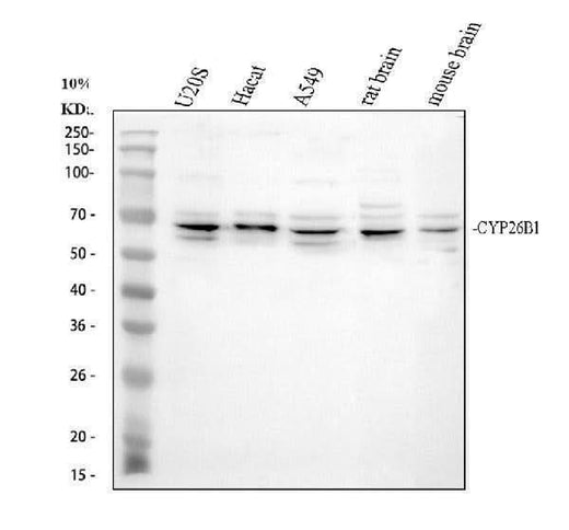 Anti-CYP26B1 Antibody Picoband® Boster Bio