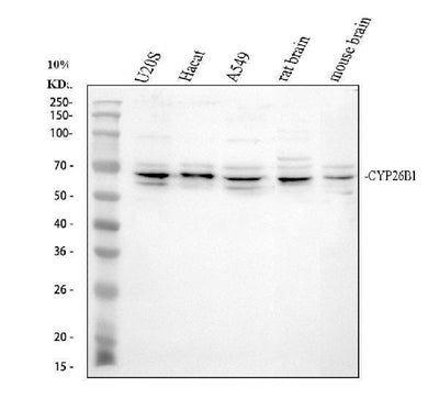 Anti-CYP26B1 Antibody Picoband® Boster Bio