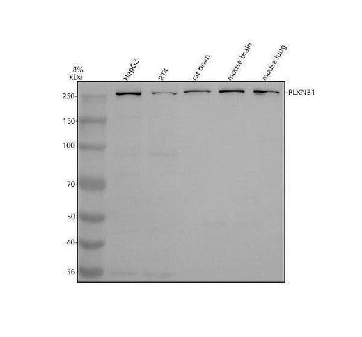 Anti-PLXNB1 Antibody Picoband® Boster Bio