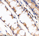Anti-PDE4A Antibody Boster Bio