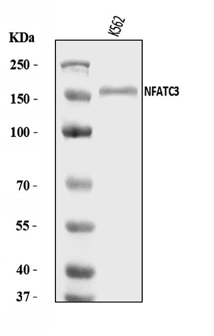 Anti-NFAT4/NF-ATc3/NFATC3 Antibody Picoband® Boster Bio