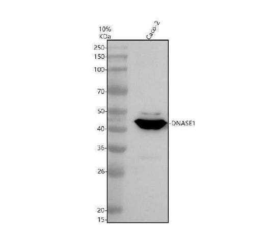 Anti-DNase I/DNASE1 Antibody Picoband® Boster Bio