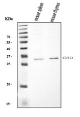 Anti-Dectin-1/Clec7a Antibody Picoband® Boster Bio