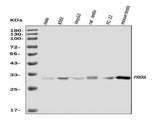 Anti-PRKRA Antibody Picoband® Boster Bio